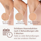 Philips Lumea IPL Haarentfernungsgerät 9000 Series – Haarentfernungsgerät mit SenseIQ Technologie, 3 Aufsätze für Körper, Gesicht und Präzision, kabellos (Modell BRI955/00)
